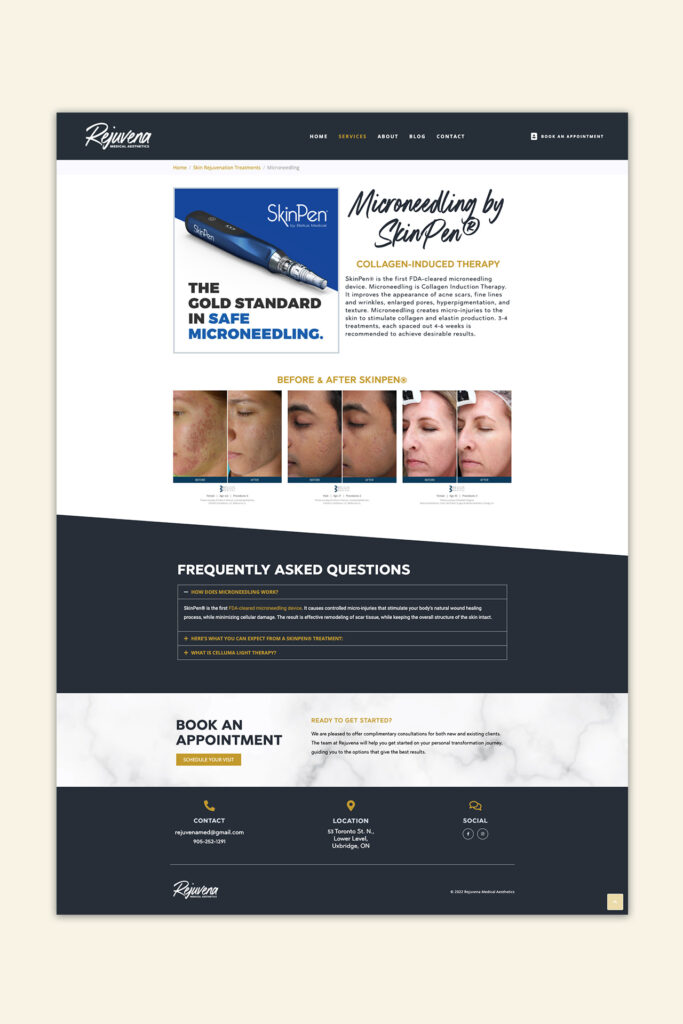 Rejuvena-Micro-Needling-Page